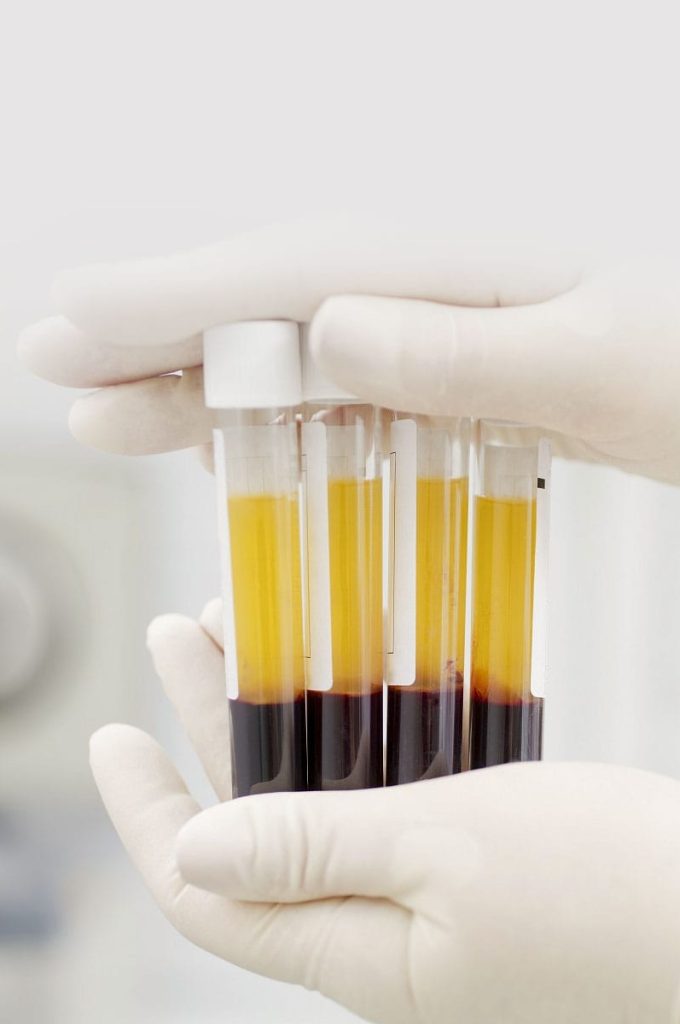 osocze-bogatyplytkowe1-1